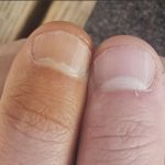 11.20.2025 – Mayoral update, School Choice forum ambush, Neal’s Orange Thumb mystery